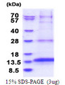 OXLD1 / C17orf90 Protein