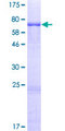 OXSM / KS Protein - 12.5% SDS-PAGE of human OXSM stained with Coomassie Blue