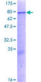 P450SCC / CYP11A1 Protein - 12.5% SDS-PAGE of human CYP11A1 stained with Coomassie Blue