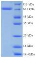 P450SCC / CYP11A1 Protein