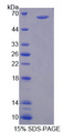 PAD2 / PADI2 Protein - Recombinant Peptidyl Arginine Deimina Type II By SDS-PAGE