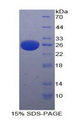 PAFAH1B3 Protein - Recombinant Platelet Activating Factor Acetylhydrolase Ib3 By SDS-PAGE