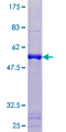 PAGE1 Protein - 12.5% SDS-PAGE of human PAGE1 stained with Coomassie Blue