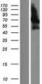 PALM2 Protein - Western validation with an anti-DDK antibody * L: Control HEK293 lysate R: Over-expression lysate