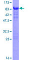 PALM2 Protein - 12.5% SDS-PAGE of human PALM2 stained with Coomassie Blue