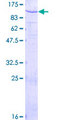 PAMR1 Protein - 12.5% SDS-PAGE of human DKFZP586H2123 stained with Coomassie Blue