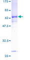 PANK3 Protein - 12.5% SDS-PAGE of human PANK3 stained with Coomassie Blue