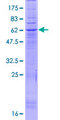 PAQR9 Protein - 12.5% SDS-PAGE of human PAQR9 stained with Coomassie Blue
