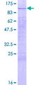PAXIP1 / PTIP Protein - 12.5% SDS-PAGE of human PAXIP1 stained with Coomassie Blue