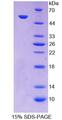 PC / Pyruvate Carboxylase Protein - Recombinant  Pyruvate Carboxylase By SDS-PAGE