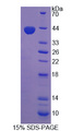 PC5 / PCSK5 Protein - Recombinant Proprotein Convertase Subtilisin/Kexin Type 5 By SDS-PAGE