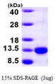 PCBD1 / PHS Protein