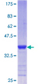 PCGF2 / MEL-18 Protein - 12.5% SDS-PAGE Stained with Coomassie Blue.