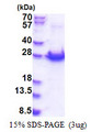 PCMTD1 Protein