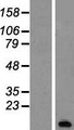 PCP4 / PEP19 Protein - Western validation with an anti-DDK antibody * L: Control HEK293 lysate R: Over-expression lysate