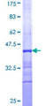 PCTP Protein - 12.5% SDS-PAGE Stained with Coomassie Blue.