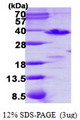 PDCL3 Protein