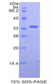 PDHB Protein - Recombinant Pyruvate Dehydrogenase Beta By SDS-PAGE