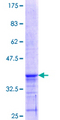 PEX11A Protein - 12.5% SDS-PAGE Stained with Coomassie Blue.