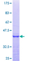 PEX14 Protein - 12.5% SDS-PAGE Stained with Coomassie Blue.