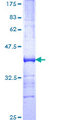 PFDN5 / MM1 Protein - 12.5% SDS-PAGE Stained with Coomassie Blue.