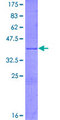 PFKFB1 Protein - 12.5% SDS-PAGE Stained with Coomassie Blue.