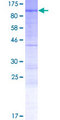 PHACTR4 Protein - 12.5% SDS-PAGE of human PHACTR4 stained with Coomassie Blue