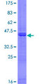 PHC3 Protein - 12.5% SDS-PAGE of human PHC3 stained with Coomassie Blue