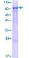 PHF21B Protein - 12.5% SDS-PAGE of human PHF21B stained with Coomassie Blue