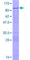 PHF23 Protein - 12.5% SDS-PAGE of human PHF23 stained with Coomassie Blue