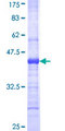 PHKA1 Protein - 12.5% SDS-PAGE Stained with Coomassie Blue.