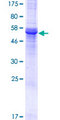 PHYHIP Protein - 12.5% SDS-PAGE of human PHYHIP stained with Coomassie Blue