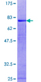 PICK1 Protein - 12.5% SDS-PAGE of human PRKCABP stained with Coomassie Blue