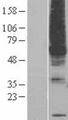 PIGM Protein - Western validation with an anti-DDK antibody * L: Control HEK293 lysate R: Over-expression lysate