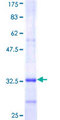 PIGM Protein - 12.5% SDS-PAGE Stained with Coomassie Blue