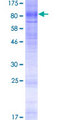 PIGZ Protein - 12.5% SDS-PAGE of human PIGZ stained with Coomassie Blue
