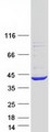 PIH1D1 Protein - Purified recombinant protein PIH1D1 was analyzed by SDS-PAGE gel and Coomassie Blue Staining