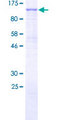 PIK3R6 Protein - 12.5% SDS-PAGE of human PIK3R6 stained with Coomassie Blue