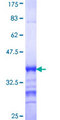 PIK3R6 Protein - 12.5% SDS-PAGE Stained with Coomassie Blue.