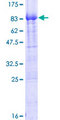 PIKFYVE / PIP5K Protein - 12.5% SDS-PAGE of human PIP5K3 stained with Coomassie Blue