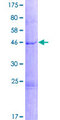 PIP5KL1 Protein - 12.5% SDS-PAGE of human PIP5KL1 stained with Coomassie Blue