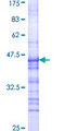 PKN2 Protein - 12.5% SDS-PAGE Stained with Coomassie Blue.