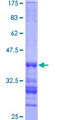 PKP3 / Plakophilin 3 Protein - 12.5% SDS-PAGE Stained with Coomassie Blue.