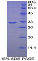 PLA2R / PLA2R1 Protein - Recombinant Phospholipase A2 Receptor 1 By SDS-PAGE