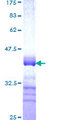 PLAGL2 Protein - 12.5% SDS-PAGE Stained with Coomassie Blue.