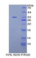 PLEKHA1 Protein - Recombinant Pleckstrin Homology Domain Containing Family A, Member 1 By SDS-PAGE