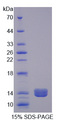 PLOD2 Protein - Recombinant Procollagen Lysine-2-Oxoglutarate-5-Dioxygenase 2 By SDS-PAGE