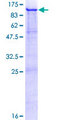PMEL / SILV / gp100 Protein - 12.5% SDS-PAGE of human SILV stained with Coomassie Blue
