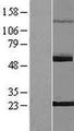 PNLDC1 Protein - Western validation with an anti-DDK antibody * L: Control HEK293 lysate R: Over-expression lysate