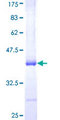 PNLIPRP2 Protein - 12.5% SDS-PAGE Stained with Coomassie Blue.